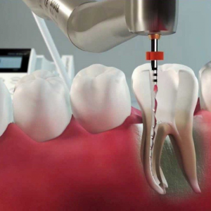 Endodontia